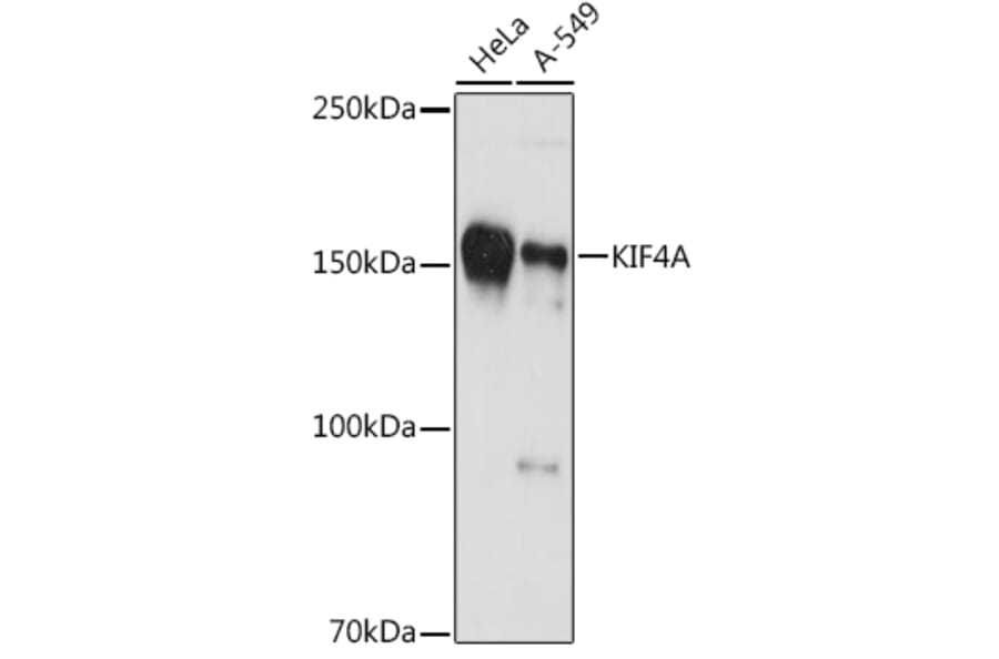Western Blot - Anti-KIF4A/KIF4 Antibody [ARC1405] (A307453) - Antibodies.com