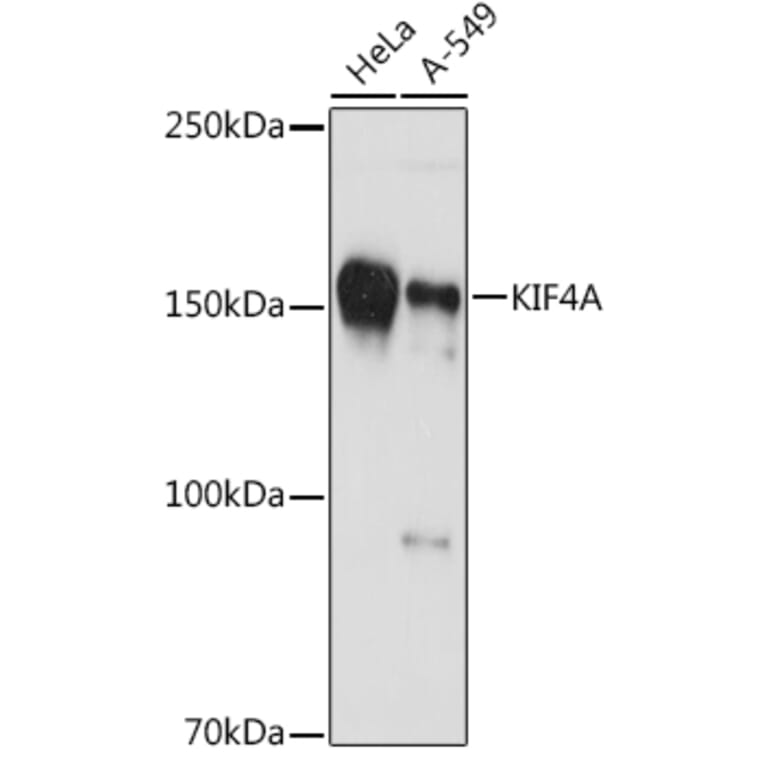 Western Blot - Anti-KIF4A/KIF4 Antibody [ARC1405] (A307453) - Antibodies.com