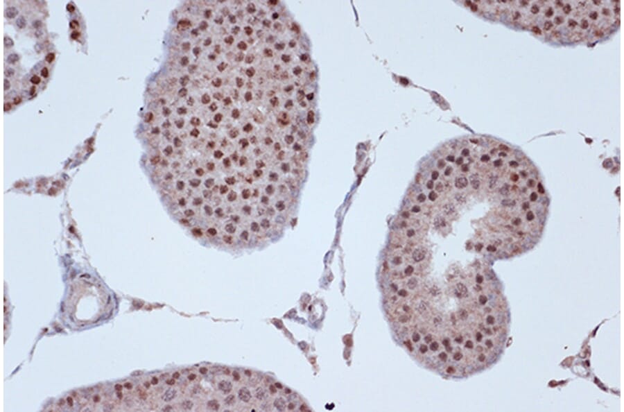 Immunohistochemistry - Anti-KIF4A/KIF4 Antibody [ARC1405] (A307453) - Antibodies.com