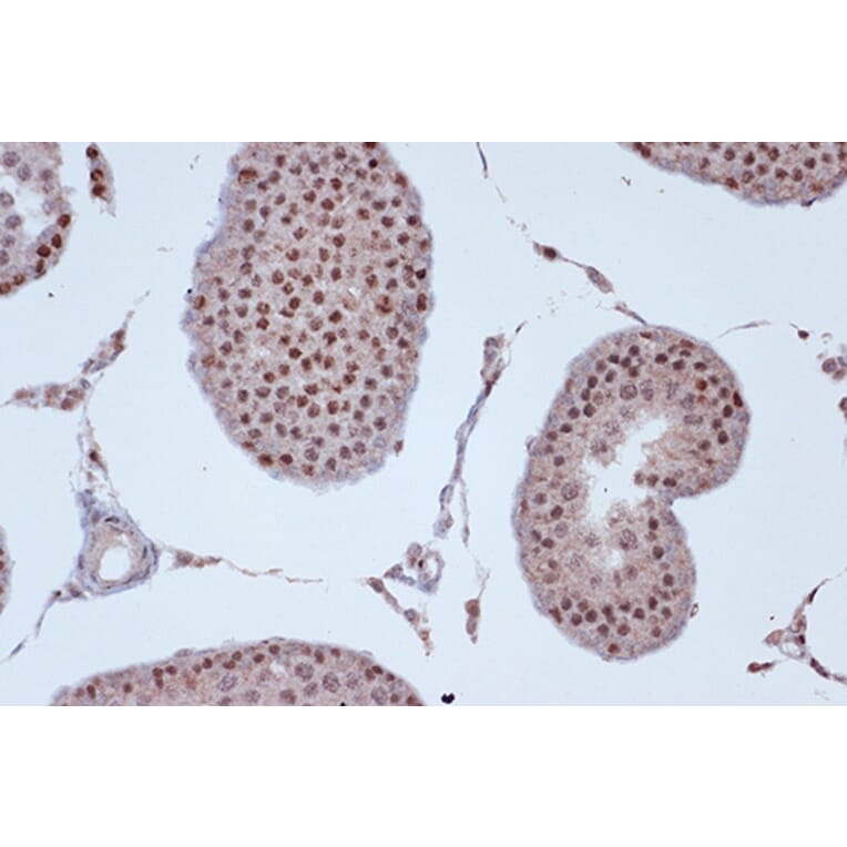 Immunohistochemistry - Anti-KIF4A/KIF4 Antibody [ARC1405] (A307453) - Antibodies.com