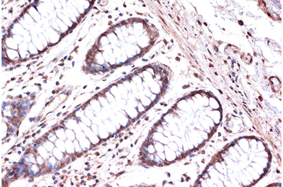 Immunohistochemistry - Anti-KIF4A/KIF4 Antibody [ARC1405] (A307453) - Antibodies.com