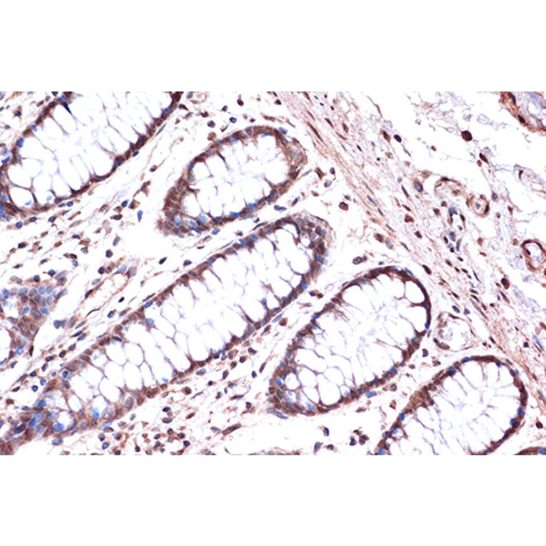 Immunohistochemistry - Anti-KIF4A/KIF4 Antibody [ARC1405] (A307453) - Antibodies.com