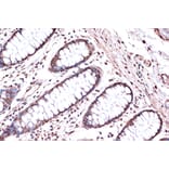 Immunohistochemistry - Anti-KIF4A/KIF4 Antibody [ARC1405] (A307453) - Antibodies.com