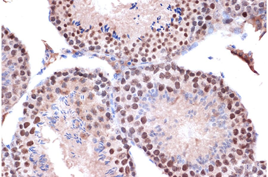 Immunohistochemistry - Anti-KIF4A/KIF4 Antibody [ARC1405] (A307453) - Antibodies.com