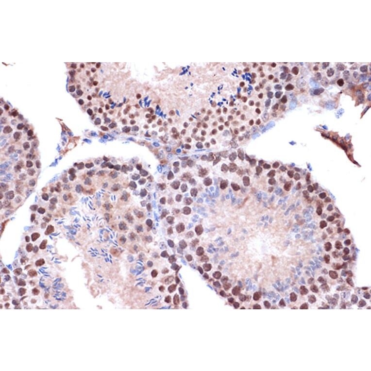 Immunohistochemistry - Anti-KIF4A/KIF4 Antibody [ARC1405] (A307453) - Antibodies.com