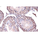 Immunohistochemistry - Anti-KIF4A/KIF4 Antibody [ARC1405] (A307453) - Antibodies.com