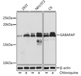 Western Blot - Anti-GABARAP Antibody [ARC1057] (A307456) - Antibodies.com