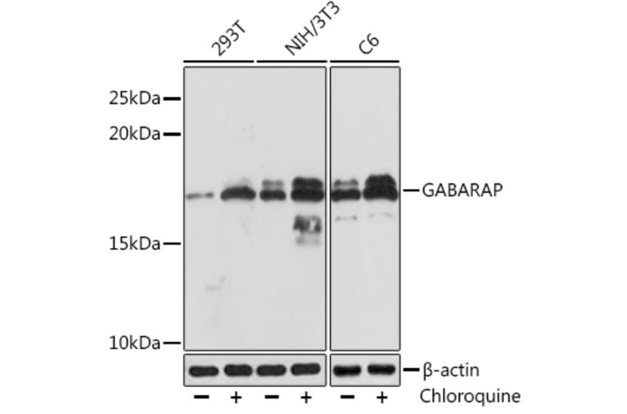 Western Blot - Anti-GABARAP Antibody [ARC1057] (A307456) - Antibodies.com