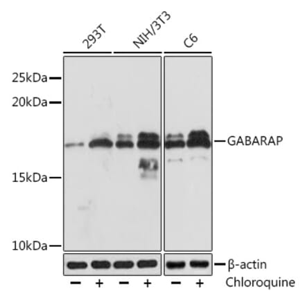 Western Blot - Anti-GABARAP Antibody [ARC1057] (A307456) - Antibodies.com