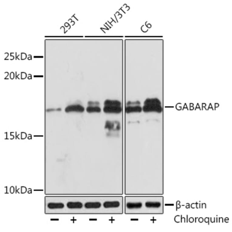 Western Blot - Anti-GABARAP Antibody [ARC1057] (A307456) - Antibodies.com