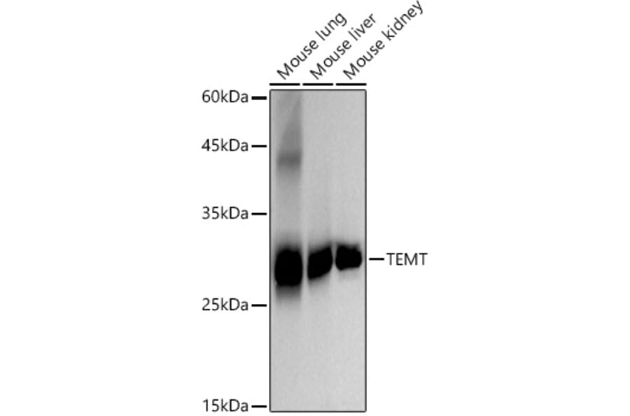 Western Blot - Anti-TEMT Antibody [ARC2950] (A307457) - Antibodies.com