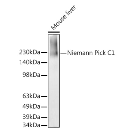 Western Blot - Anti-Niemann Pick C1 Antibody [ARC2713] (A307458) - Antibodies.com