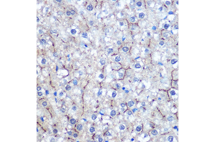 Immunohistochemistry - Anti-HIG2 Antibody (A307460) - Antibodies.com