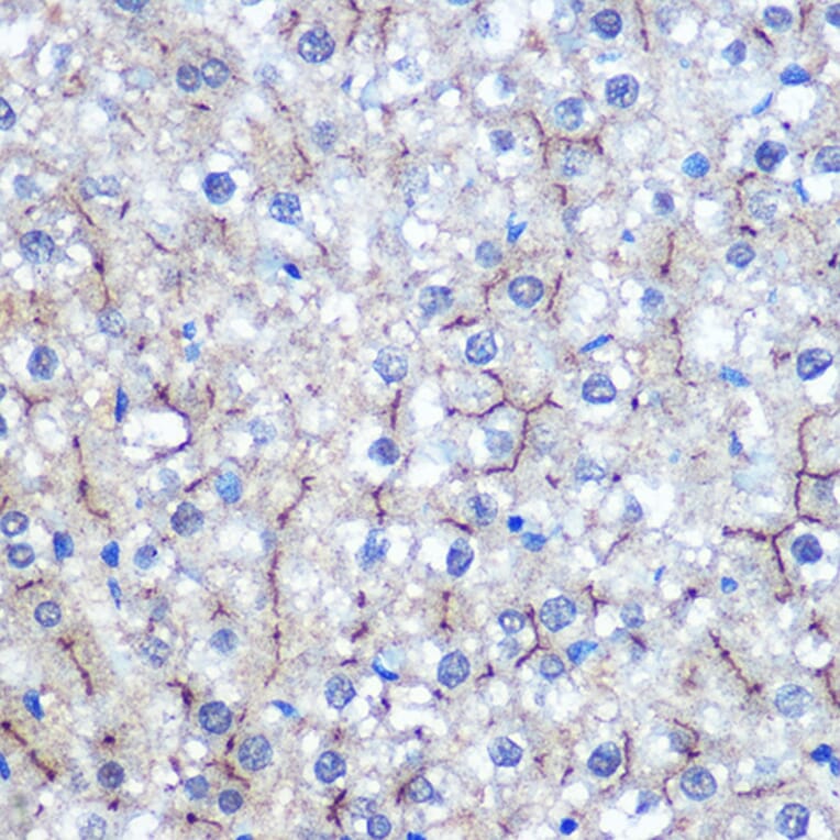 Immunohistochemistry - Anti-HIG2 Antibody (A307460) - Antibodies.com