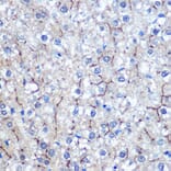 Immunohistochemistry - Anti-HIG2 Antibody (A307460) - Antibodies.com