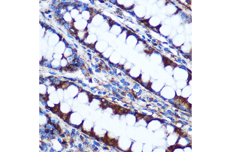 Immunohistochemistry - Anti-HIG2 Antibody (A307460) - Antibodies.com