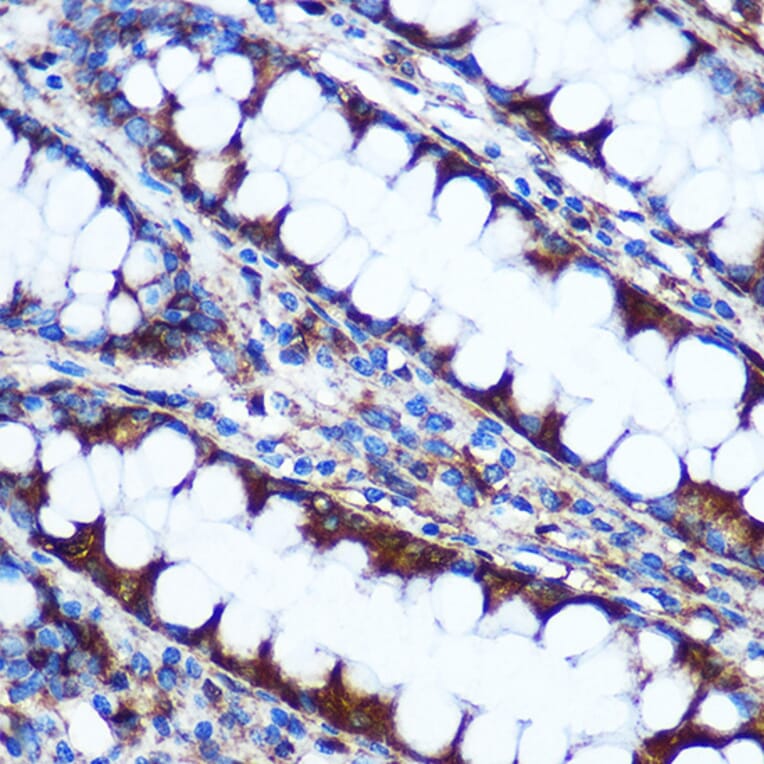 Immunohistochemistry - Anti-HIG2 Antibody (A307460) - Antibodies.com