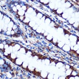 Immunohistochemistry - Anti-HIG2 Antibody (A307460) - Antibodies.com