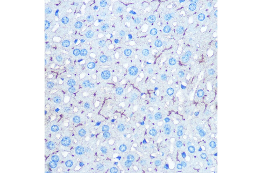 Immunohistochemistry - Anti-HIG2 Antibody (A307460) - Antibodies.com