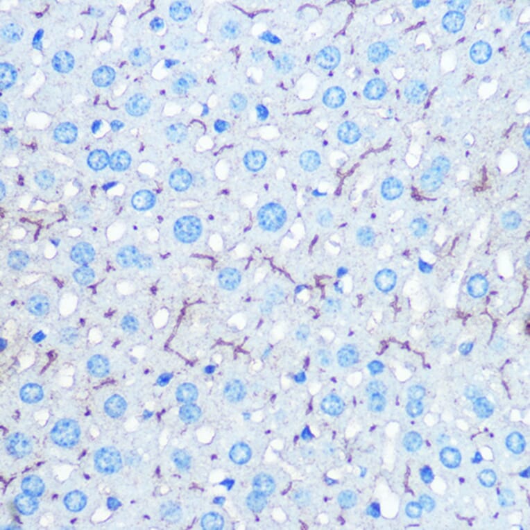 Immunohistochemistry - Anti-HIG2 Antibody (A307460) - Antibodies.com