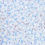 Immunohistochemistry - Anti-HIG2 Antibody (A307460) - Antibodies.com