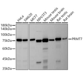 Western Blot - Anti-PRMT7 Antibody [ARC2967] (A307461) - Antibodies.com