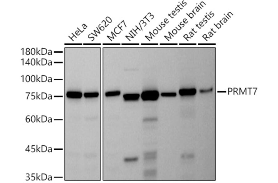 Western Blot - Anti-PRMT7 Antibody [ARC2967] (A307461) - Antibodies.com