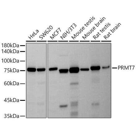 Western Blot - Anti-PRMT7 Antibody [ARC2967] (A307461) - Antibodies.com