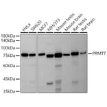 Western Blot - Anti-PRMT7 Antibody [ARC2967] (A307461) - Antibodies.com