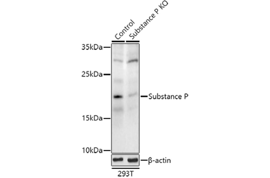 Western Blot - Anti-Substance P Antibody (A307462) - Antibodies.com