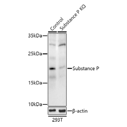 Western Blot - Anti-Substance P Antibody (A307462) - Antibodies.com