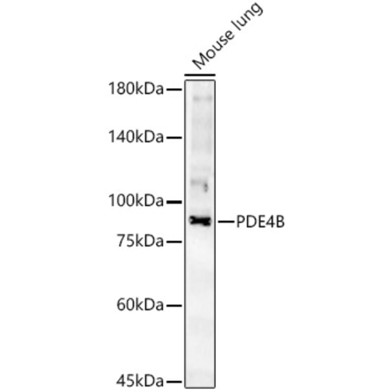 Western Blot - Anti-PDE4B Antibody (A307463) - Antibodies.com