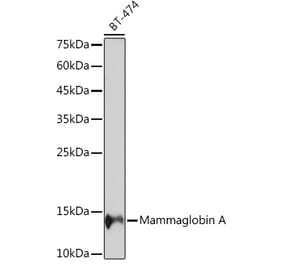 Western Blot - Anti-Mammaglobin A Antibody [ARC2255] (A307465) - Antibodies.com