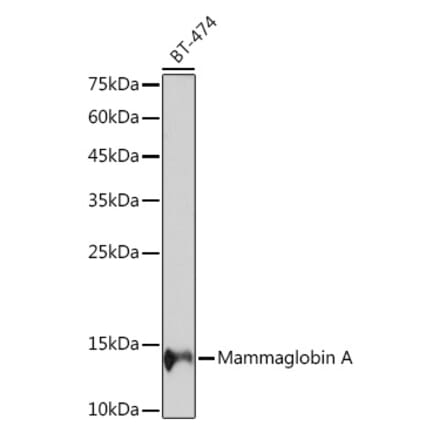 Western Blot - Anti-Mammaglobin A Antibody [ARC2255] (A307465) - Antibodies.com