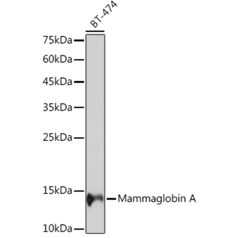 Western Blot - Anti-Mammaglobin A Antibody [ARC2255] (A307465) - Antibodies.com