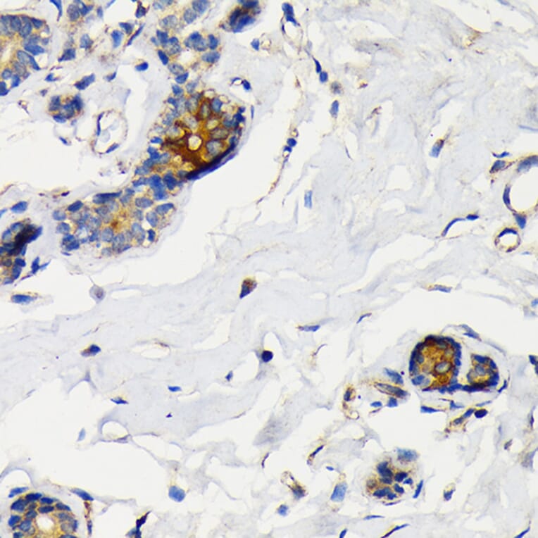 Immunohistochemistry - Anti-Mammaglobin A Antibody [ARC2255] (A307465) - Antibodies.com