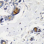 Immunohistochemistry - Anti-Mammaglobin A Antibody [ARC2255] (A307465) - Antibodies.com