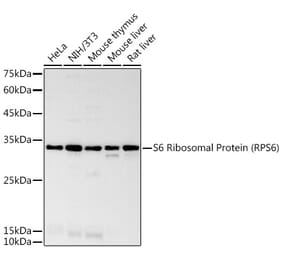 Western Blot - Anti-RPS6 Antibody [ARC50655] (A307466) - Antibodies.com