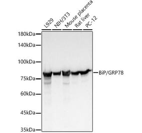 Western Blot - Anti-GRP78 BiP Antibody [ARC1141] (A307467) - Antibodies.com