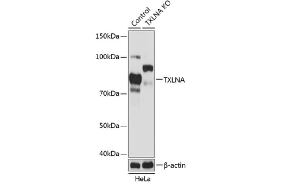 Western Blot - Anti-Alpha Taxilin Antibody (A307468) - Antibodies.com