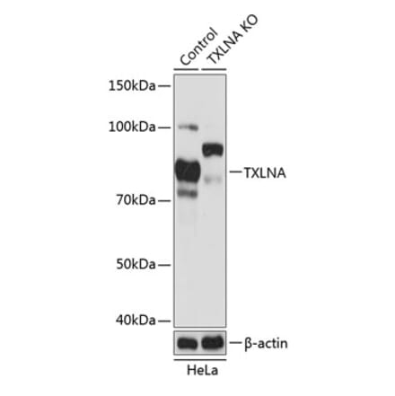 Western Blot - Anti-Alpha Taxilin Antibody (A307468) - Antibodies.com