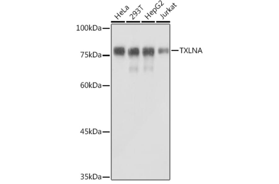 Western Blot - Anti-Alpha Taxilin Antibody (A307469) - Antibodies.com