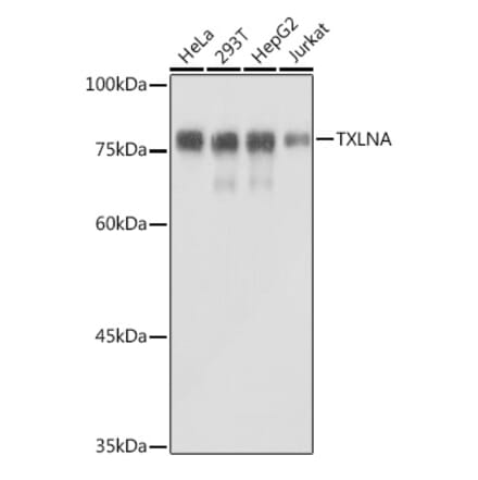Western Blot - Anti-Alpha Taxilin Antibody (A307469) - Antibodies.com
