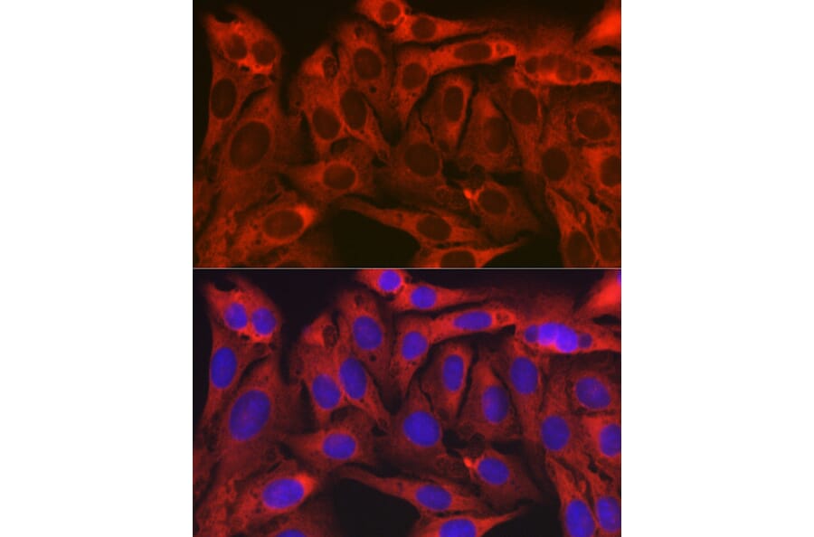 Immunofluorescence - Anti-Alpha Taxilin Antibody (A307469) - Antibodies.com