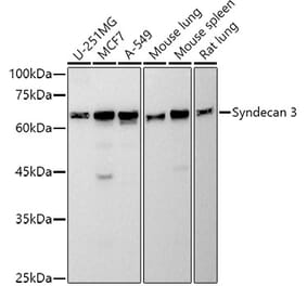 Western Blot - Anti-Syndecan 3 Antibody [ARC2907] (A307470) - Antibodies.com