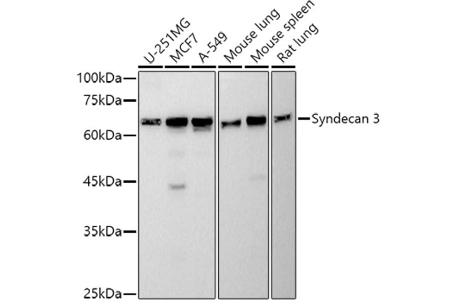 Western Blot - Anti-Syndecan 3 Antibody [ARC2907] (A307470) - Antibodies.com