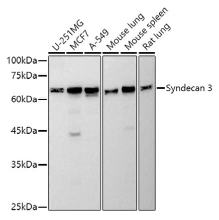 Western Blot - Anti-Syndecan 3 Antibody [ARC2907] (A307470) - Antibodies.com