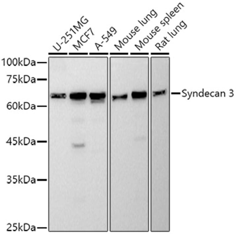 Western Blot - Anti-Syndecan 3 Antibody [ARC2907] (A307470) - Antibodies.com
