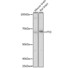 Western Blot - Anti-FTO Antibody (A307471) - Antibodies.com