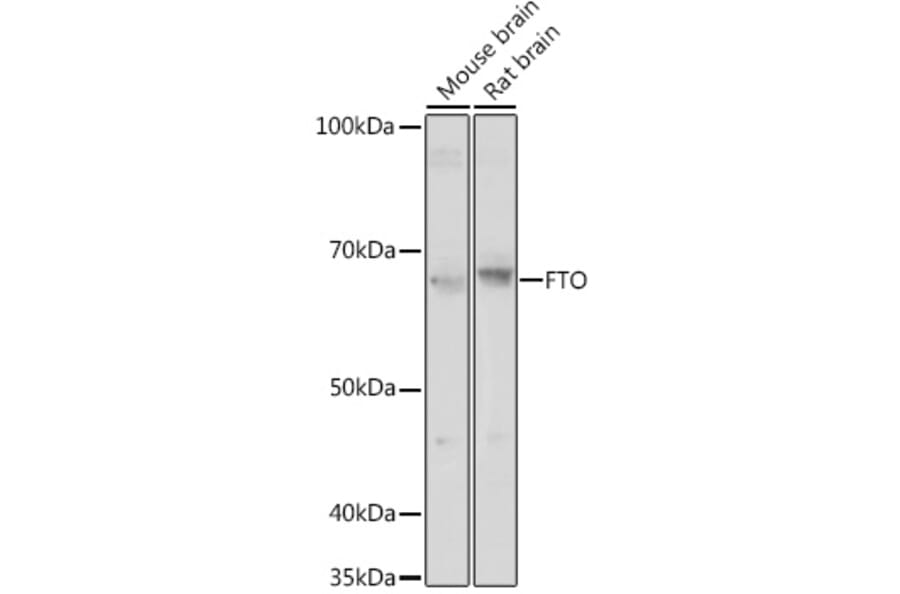 Western Blot - Anti-FTO Antibody (A307471) - Antibodies.com